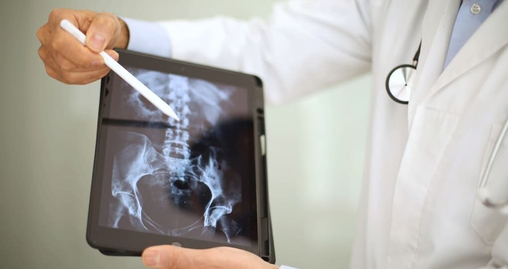 Duchenne (DMD): opciones de tratamiento en Costa Rica