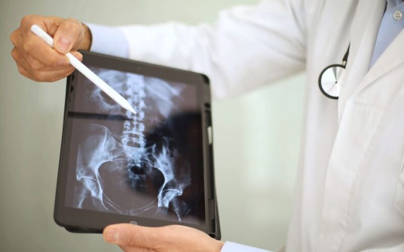 Duchenne (DMD): opciones de tratamiento en Costa Rica