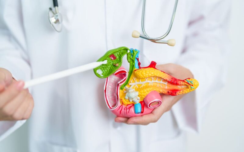 Quilomicronemia en Costa Rica: conoce el papel de los genes LPL y APOA5